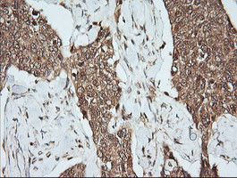 MAP2K1 Antibody in Immunohistochemistry (Paraffin) (IHC (P))