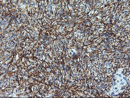 MAP2K1 Antibody in Immunohistochemistry (Paraffin) (IHC (P))