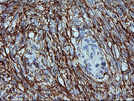 MAP2K1 Antibody in Immunohistochemistry (Paraffin) (IHC (P))