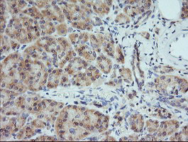 MAP2K1 Antibody in Immunohistochemistry (Paraffin) (IHC (P))