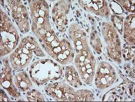 MAP2K1 Antibody in Immunohistochemistry (Paraffin) (IHC (P))