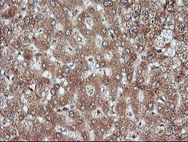 MAP2K1 Antibody in Immunohistochemistry (Paraffin) (IHC (P))