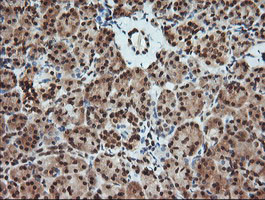 MAP2K1 Antibody in Immunohistochemistry (Paraffin) (IHC (P))