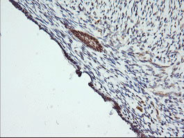 MAP2K1 Antibody in Immunohistochemistry (Paraffin) (IHC (P))