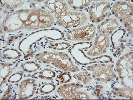 MAP2K1 Antibody in Immunohistochemistry (Paraffin) (IHC (P))