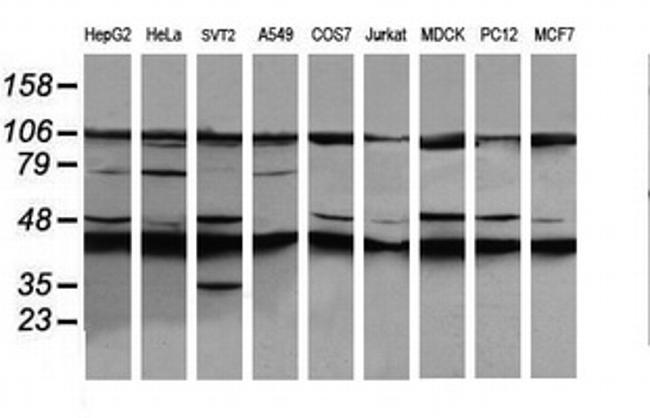 MAP2K1 Antibody in Western Blot (WB)