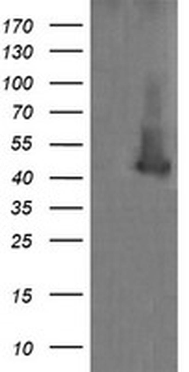 MAP2K1 Antibody in Western Blot (WB)