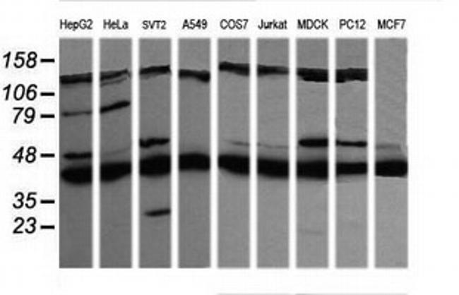 MAP2K1 Antibody in Western Blot (WB)