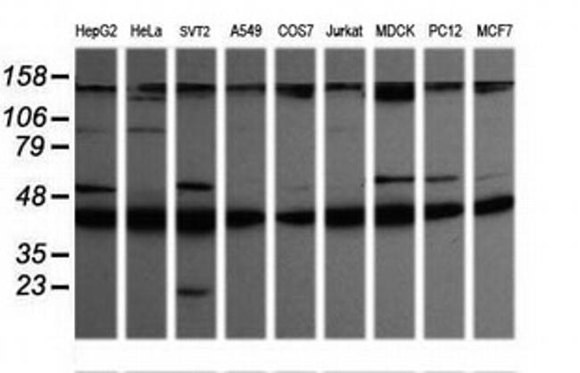 MAP2K1 Antibody in Western Blot (WB)