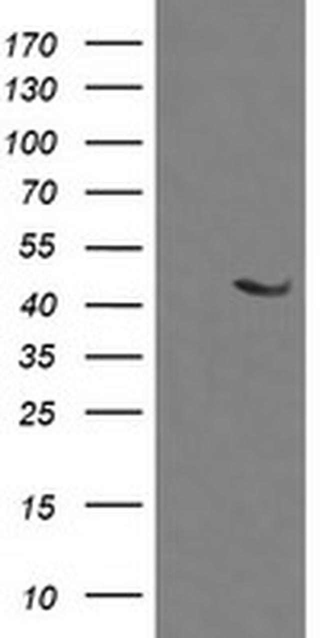 MAP2K1 Antibody in Western Blot (WB)