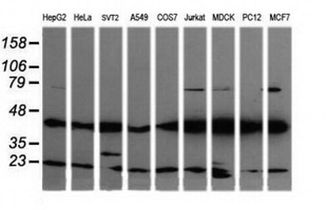 MAP2K1 Antibody in Western Blot (WB)