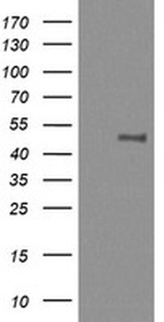 MAP2K1 Antibody in Western Blot (WB)