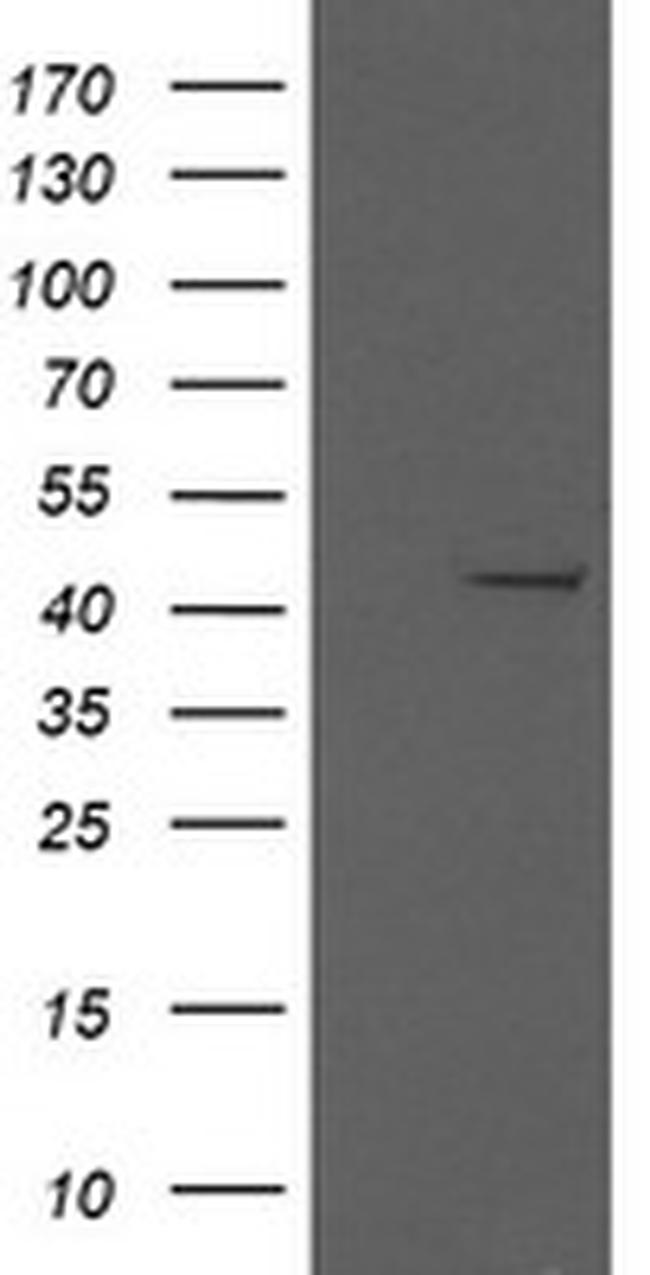 MAP2K1 Antibody in Western Blot (WB)