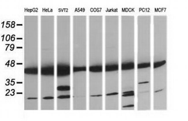 MAP2K1 Antibody in Western Blot (WB)