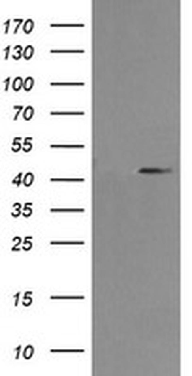 MAP2K1 Antibody in Western Blot (WB)