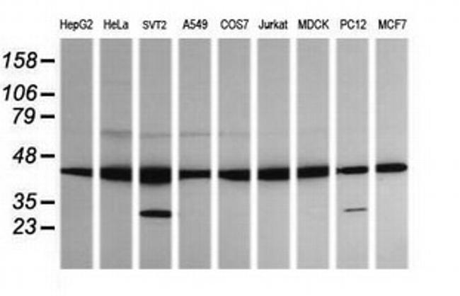 MAP2K1 Antibody in Western Blot (WB)