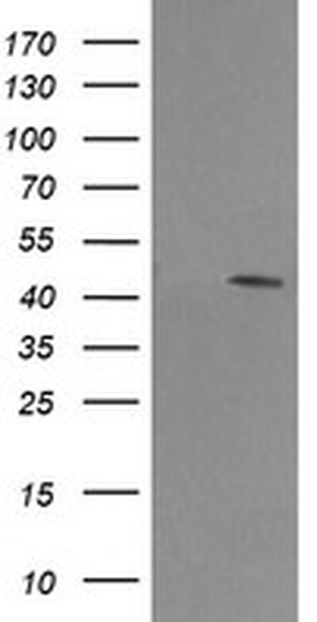 MAP2K1 Antibody in Western Blot (WB)