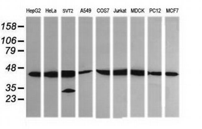 MAP2K1 Antibody in Western Blot (WB)