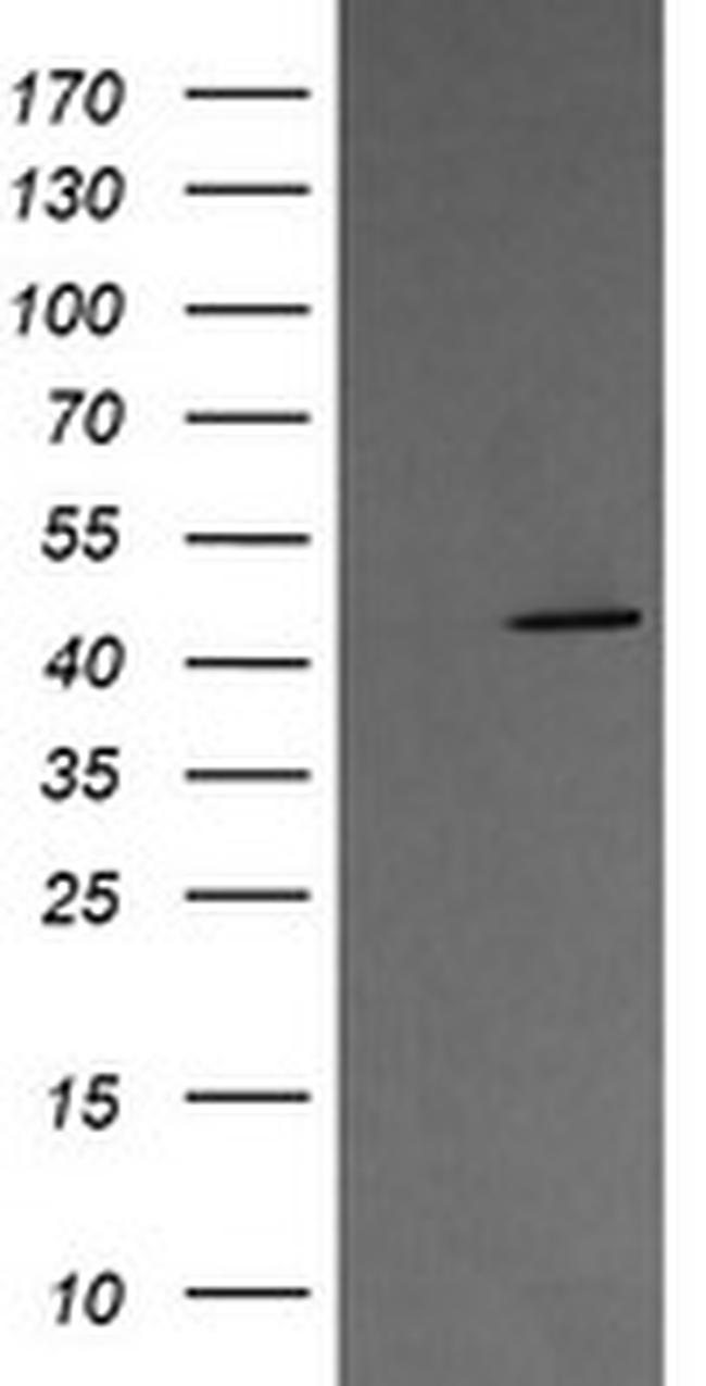 MAP2K1 Antibody in Western Blot (WB)