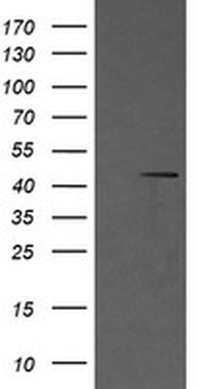 MAP2K1 Antibody in Western Blot (WB)