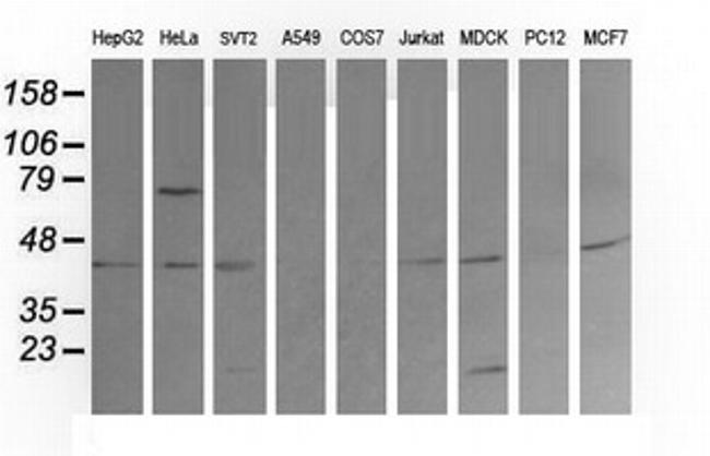 MAP2K1 Antibody in Western Blot (WB)