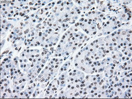 MAP2K2 Antibody in Immunohistochemistry (Paraffin) (IHC (P))