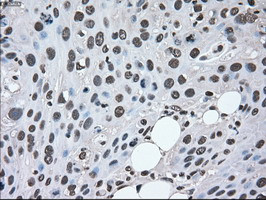 MAP2K2 Antibody in Immunohistochemistry (Paraffin) (IHC (P))