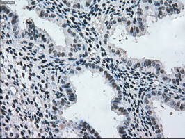 MAP2K2 Antibody in Immunohistochemistry (Paraffin) (IHC (P))