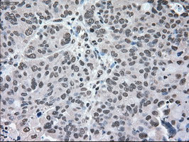 MAP2K2 Antibody in Immunohistochemistry (Paraffin) (IHC (P))