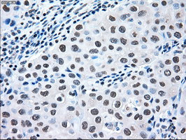 MAP2K2 Antibody in Immunohistochemistry (Paraffin) (IHC (P))