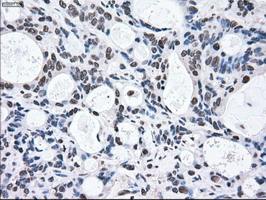 MAP2K2 Antibody in Immunohistochemistry (Paraffin) (IHC (P))