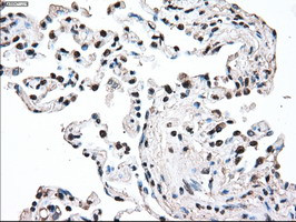 MAP2K2 Antibody in Immunohistochemistry (Paraffin) (IHC (P))