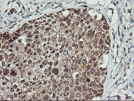 MAP2K2 Antibody in Immunohistochemistry (Paraffin) (IHC (P))