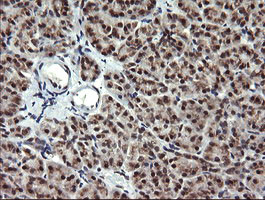 MAP2K2 Antibody in Immunohistochemistry (Paraffin) (IHC (P))