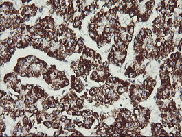 MAP2K2 Antibody in Immunohistochemistry (Paraffin) (IHC (P))