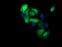 MAP2K3 Antibody in Immunocytochemistry (ICC/IF)