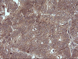 MAP2K3 Antibody in Immunohistochemistry (Paraffin) (IHC (P))