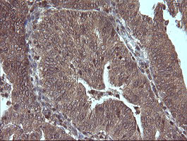 MAP2K3 Antibody in Immunohistochemistry (Paraffin) (IHC (P))