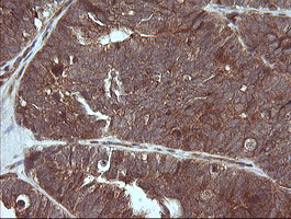 MAP2K3 Antibody in Immunohistochemistry (Paraffin) (IHC (P))