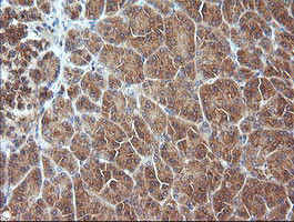 MAP2K3 Antibody in Immunohistochemistry (Paraffin) (IHC (P))