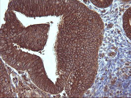 MAP2K3 Antibody in Immunohistochemistry (Paraffin) (IHC (P))