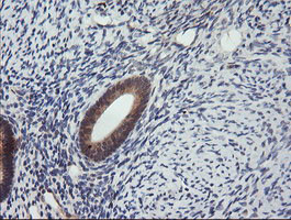 MAP2K3 Antibody in Immunohistochemistry (Paraffin) (IHC (P))