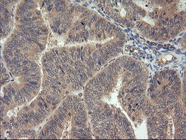 MAP2K3 Antibody in Immunohistochemistry (Paraffin) (IHC (P))