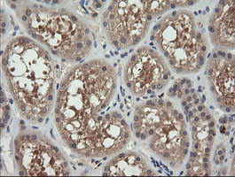 MAP2K3 Antibody in Immunohistochemistry (Paraffin) (IHC (P))