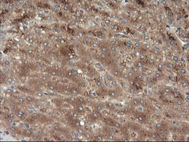 MAP2K3 Antibody in Immunohistochemistry (Paraffin) (IHC (P))