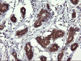 MAP2K3 Antibody in Immunohistochemistry (Paraffin) (IHC (P))