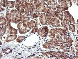 MAP2K3 Antibody in Immunohistochemistry (Paraffin) (IHC (P))