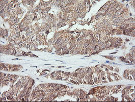 MAP2K3 Antibody in Immunohistochemistry (Paraffin) (IHC (P))