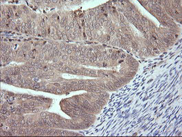 MAP2K3 Antibody in Immunohistochemistry (Paraffin) (IHC (P))