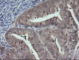 MAP2K3 Antibody in Immunohistochemistry (Paraffin) (IHC (P))